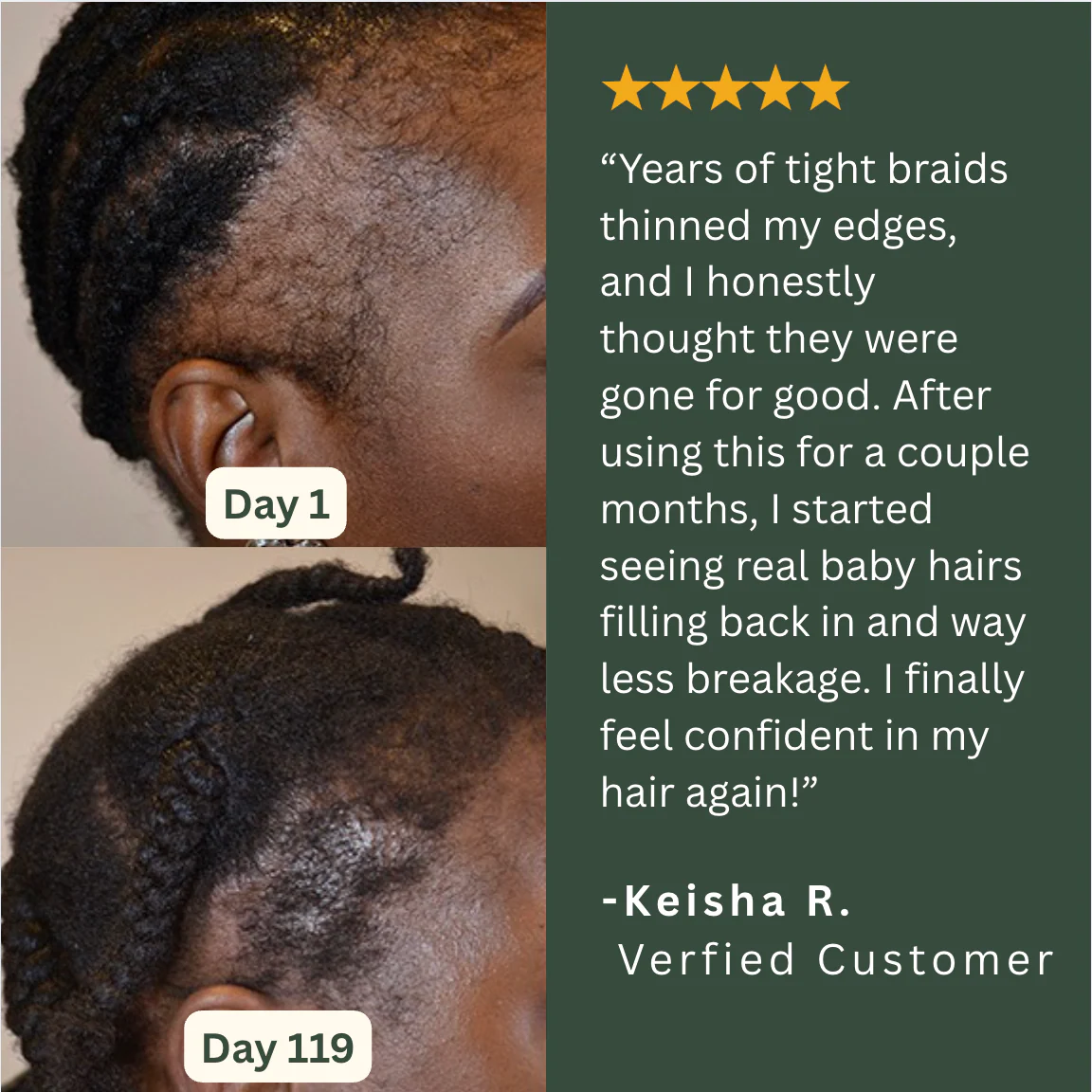 Willo Hair Growth Capsules