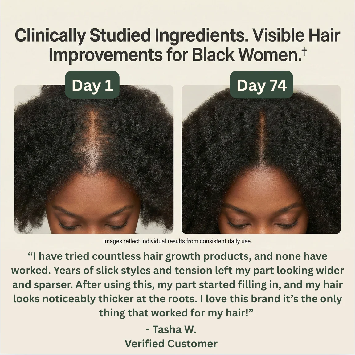 Willo Hair Growth Capsules